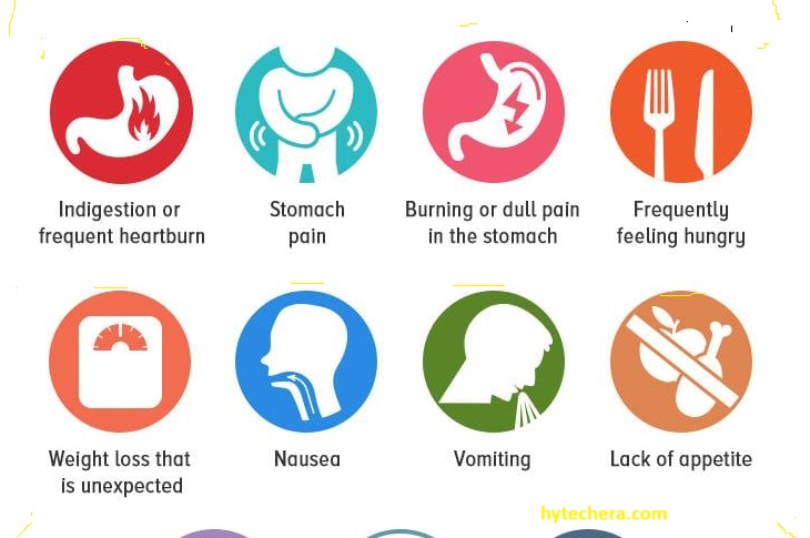 Signs and symptoms of peptic ulcer Medical chart showing symptoms like vomiting and weight loss from ulcers